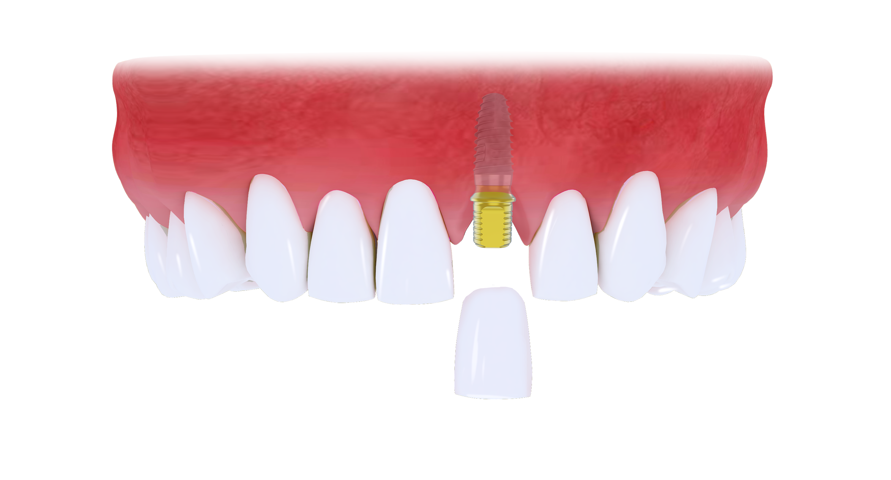 1655441623802374.png 微信圖片_20211230164308.png